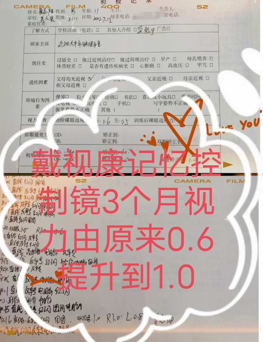 恭喜夏紫怡、夏志阳兄妹戴视康记忆控制镜3个月视力提升到1.0，1.2