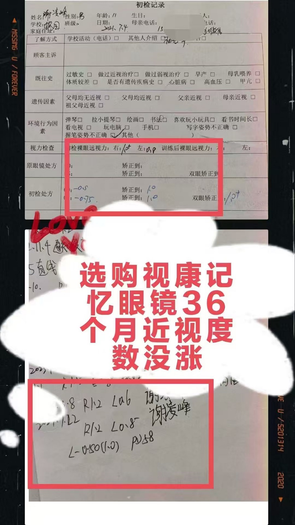 恭喜谢凌峰选购视康记忆眼镜36个月近视度数没涨