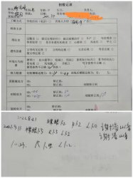 假性近视如不及时控制会变成真性近视，就会摘不掉眼镜